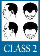 class2