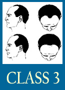 class3