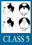 class5