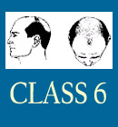 class6