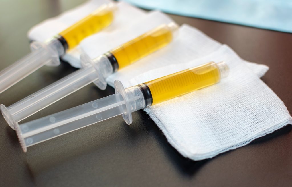 syringes of platelet-rich plasma