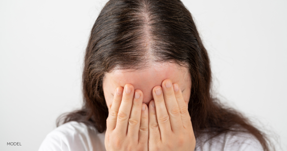 woman with thinning hair covering face with hands