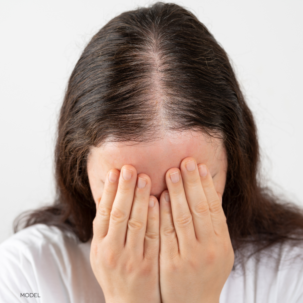 woman with thinning hair covering face with hands