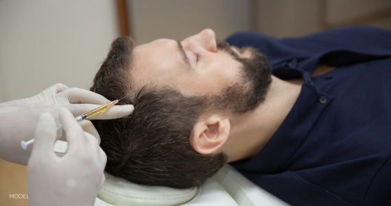 man laying down in procedure chair, with physician injecting PRP to thinning area on his scalp