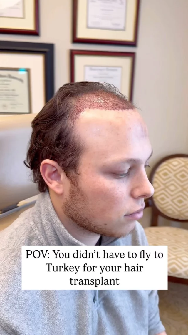 Why fly all the way to Turkey for a hair transplant when top-quality care is right here? 

We offer superior results with world class surgeons, the latest techniques, and personalized care—all without the hassle of international travel. Get the hair you want, close to home!

#hairtransplant #hairtransplantsurgery #hairtransplantturkey #hairsurgeon #thinninghair