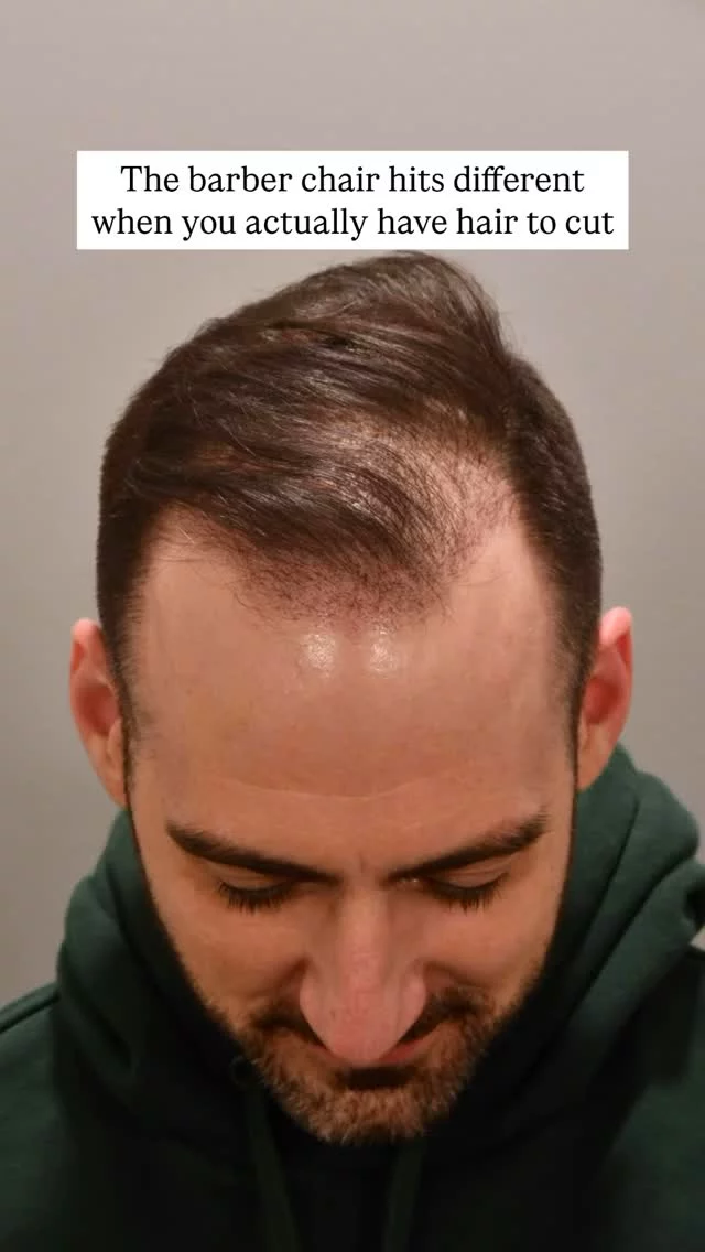 Fresh from the barber – and you’d never guess he had a hair transplant. 2+ years post-FUE, and with finasteride in the mix, this is what real results look like. 

Grafts: 2,000 
Technique: Scarless/FUE 
Surgeon: Dr. Heather Lee

#hairtransplantsurgery #finasteride #hairlosstreatment #hairloss #hairrestoration