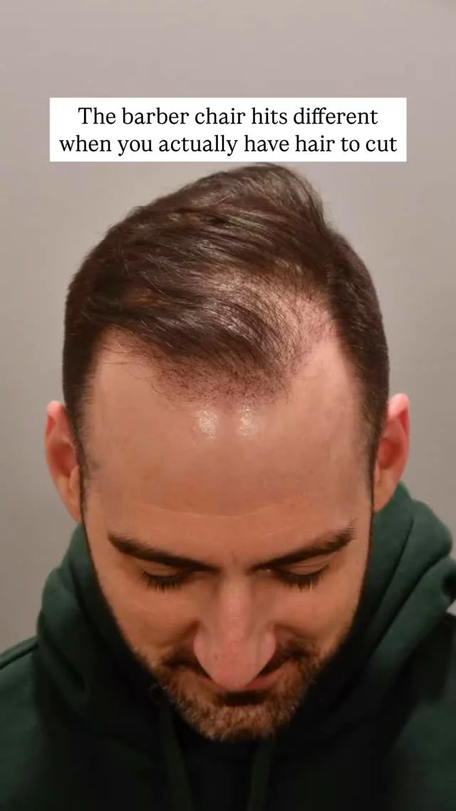 Fresh from the barber – and you’d never guess he had a hair transplant. 2+ years post-FUE, and with finasteride in the mix, this is what real results look like. 

Grafts: 2,000 
Technique: Scarless/FUE 
Surgeon: Dr. Heather Lee

#hairtransplantsurgery #finasteride #hairlosstreatment #hairloss #hairrestoration